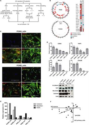Live-Cell Mesothelioma Biobank to Explore Mechanisms of Tumor Progression
